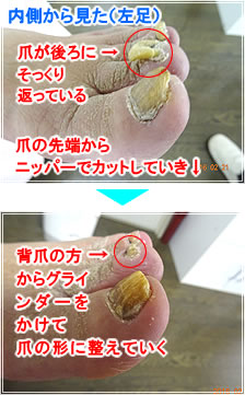 爪が後ろにそっくり返っている。爪の先端からニッパーでカットしていき、背爪の方からグラインダーをかけて、爪の形に整えていく。
