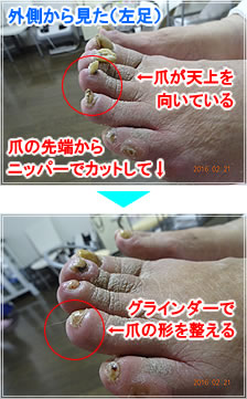 爪の先端からニッパーでカットして、グラインダーで爪の形を整える